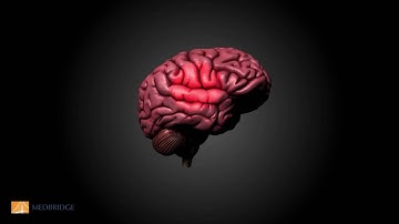 Theory of Mind Video - Martha Burns | MedBridge