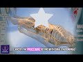 Prostate Surgery | Robotic prostatectomy Procedure | 3D Animation