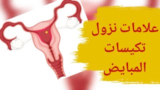 علامات نزول تكيسات المبايض | علامات اختفاء تكيس المبايض | كيف اعرف ان الكيس على المبيض نزل