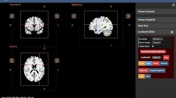 Landmark Editor Tutorial