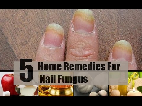 Natural Nail Fungus Treatments: Effective Home Remedies