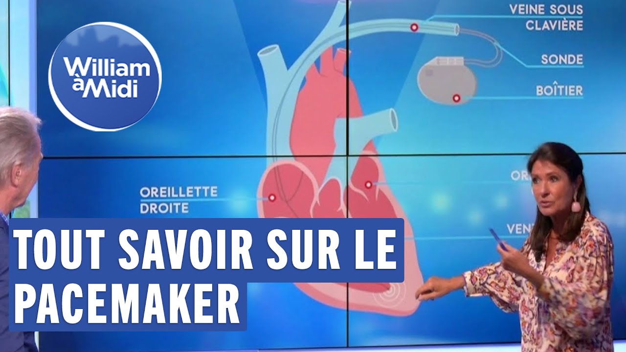 Pacemaker comment a marche 