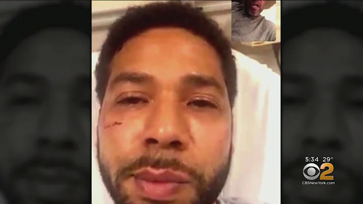 Police: Jussie Smollett Now A Suspect In Attack Case