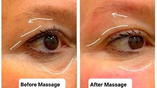 5 MINUTE Effective Massage to Tighten Droopy Eyelid | Eyebrow Lifting Massage