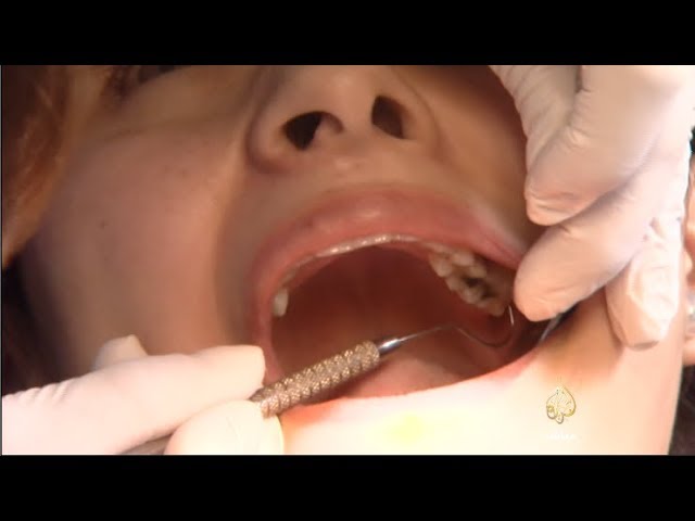 ساعة صباح.. نصائح للحفاظ على صحة الفم والأسنان