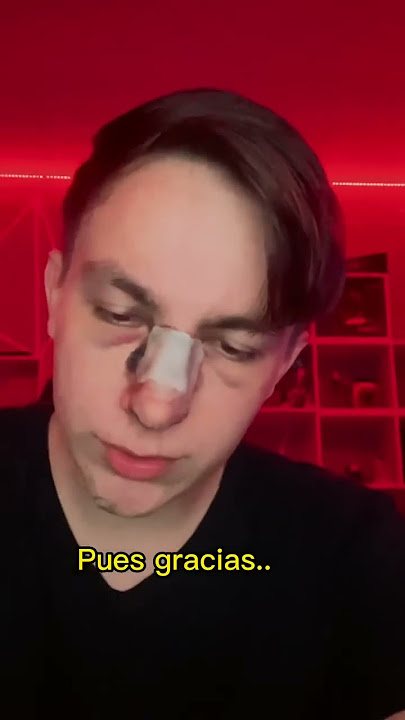 “OYE LO DE TU NARIZ ERA BROMA😂”