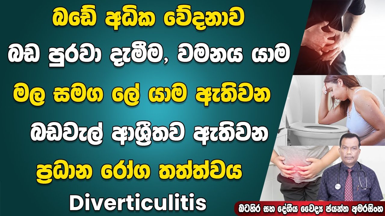 බඩේ අධික වේදනාව, බඩ පුරවා දැමීම, වමනය, මල සමග ලේයාම ඇතිවන බඩවැල් ආශ්‍රිත රෝගී තත්ත්වය Diverticulitis