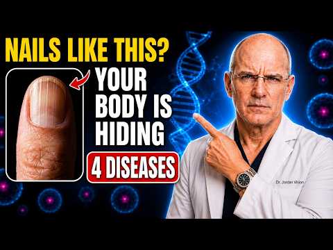 Cardiologist Warns: If Your NAILS Look Like THIS After 60, Your Heart May Be in Danger