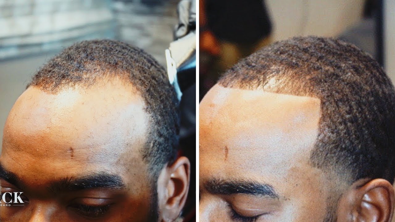 The BEST HAIRCUT & Advice For A RECEDING HAIRLINE (Part 2) - YouTube