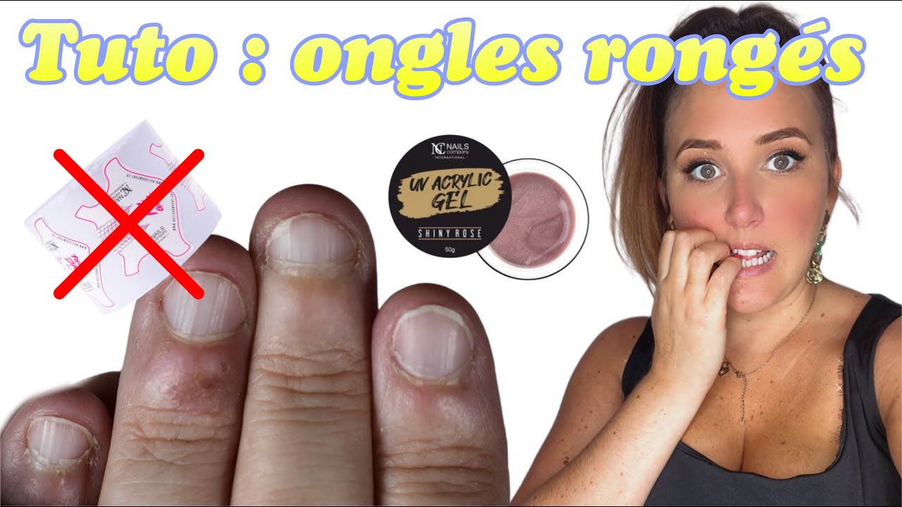ONGLES RONGES : fini la galère !