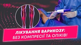 Лікування варикозу без опіків та компресійних панчіх!