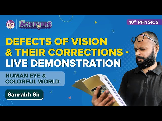 Iris of the Eye  Definition, Function & Parts - Video & Lesson