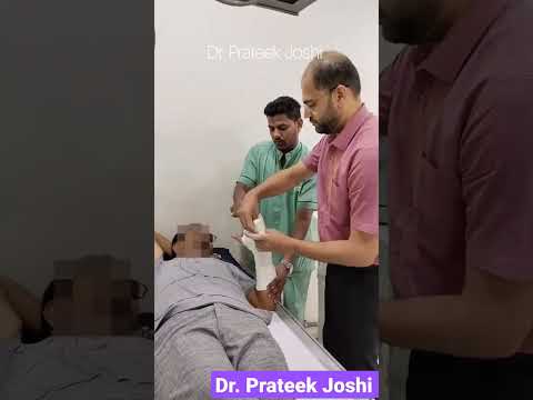 تطبيق جص كسور الأصابع جص زلالي لعظم الزند تقويم العظام كسر سروال قصير