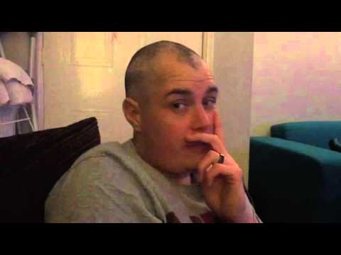 When hair falls out due to chemo - Cancer Diary | Fighting ...