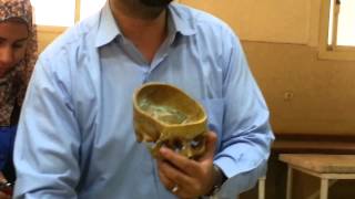 cranial cavity l dr  A  Farid l P1