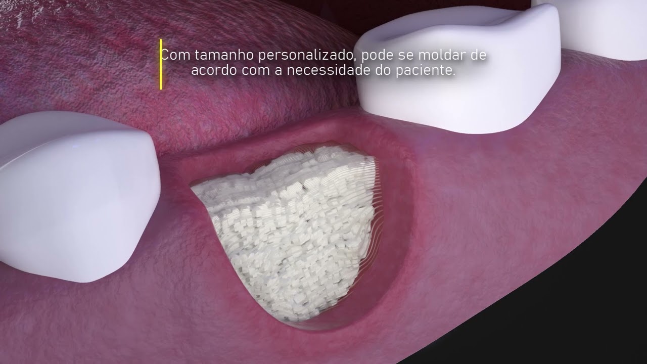 LUMINA DERMAL - a nova membrana da Criteria Biomateriais