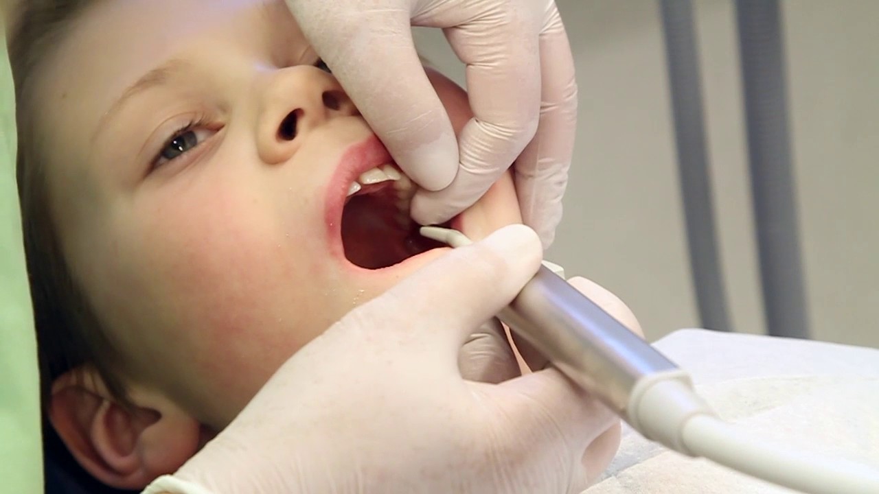 Polering och fluorlack (svenska) - Folktandvården, Region Jönköpings län