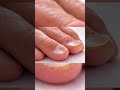 Decode Your Nails: What They Reveal About Your Health! 🔍