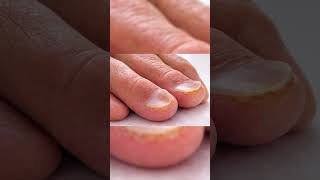 Decode Your Nails: What They Reveal About Your Health! 🔍