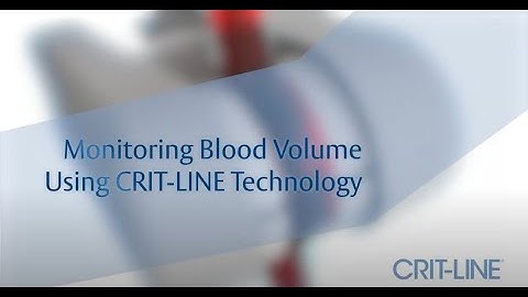 Blood Volume Monitoring Using Crit-Line® Technology