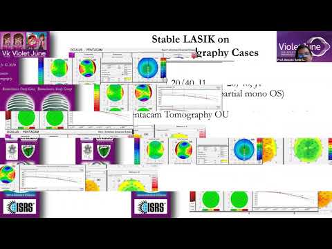 REDEFINING FORME FRUSTE KERATOCONUS - Renato Ambrosio