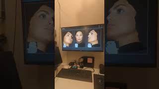 3D Imaging - Behind the Scenes