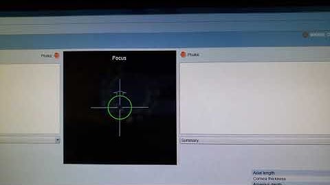 Lenstar Tutorial for Technicians