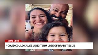 New study finds evidence of brain damage from COVID-19