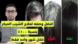 اقوي وصفة لعلاج الشيب المبكر خلال شهر واحد فقط بنسبة ١٠٠٪؜