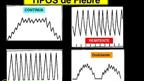 ¿Cuántos tipos de fiebre hay?