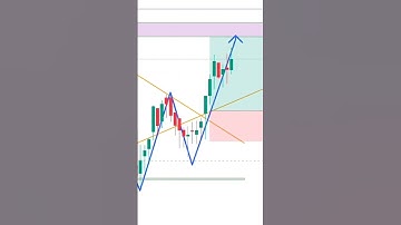 Scalping Strategy #tradesentry #scalping #optionstrading