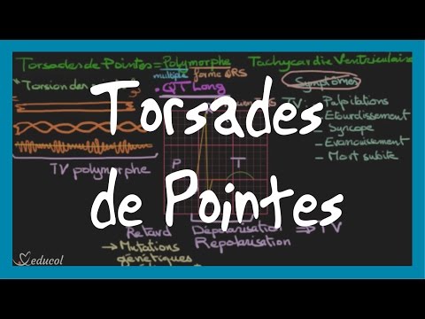 Vidéo: Torsades De Pointes: Symptômes, Causes, Traitement, Etc