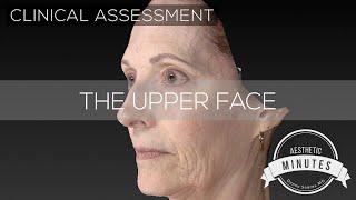 67 yo Female Brow Lift &amp; Facelift | Aesthetic Minutes #BrowLift