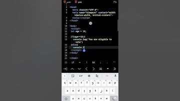 Conditions In Javascript || If Else Statement in Js #shorts