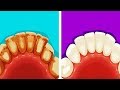 13 EFFECTIVE LIFE HACKS FOR YOUR TEETH