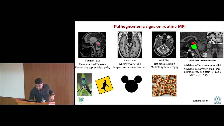 Biomarkers in Parkinson's Disease
