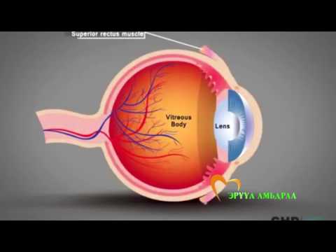 Видео: Гэрийн нөхцөлд нүдний даралтыг эмчлэх