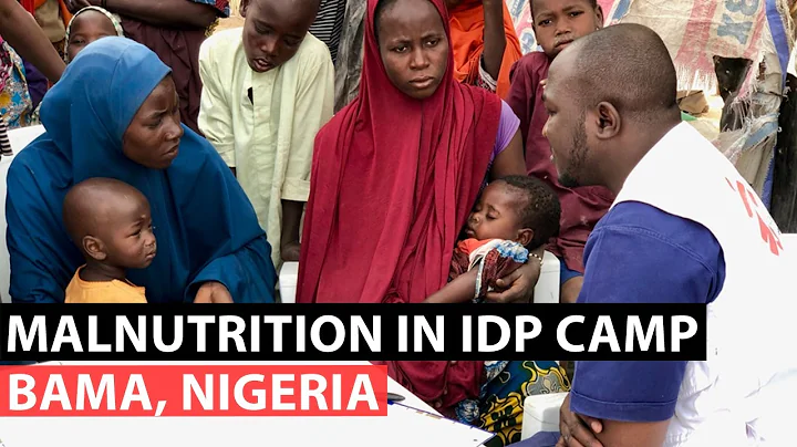 Report: Malnutrition in IDP camp in Bama, Nigeria