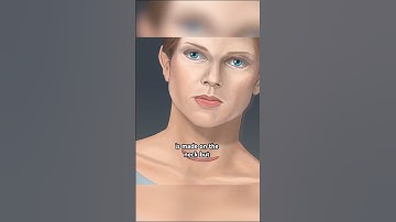 Thyroid Gland Removal Surgery!! #drone #theflash #space #automobile #scifi #epic #anatomy #like