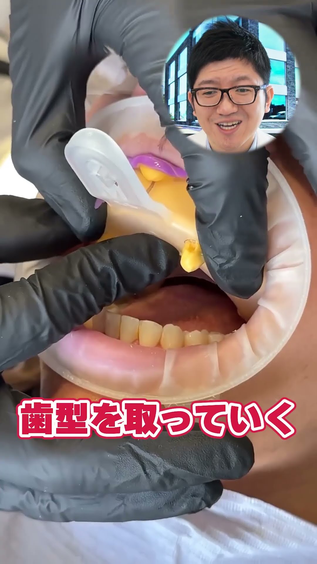 ウィリーゲラー氏の講演とテーブルクリニックビデオ　3本　ポーセレン　歯科技工 Implants] The dentist explains the treatment process of taking