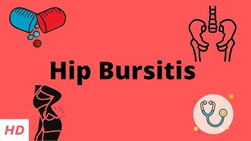 Hip Bursitis, Causes, Signs and Symptoms, Diagnosis and Treatment.