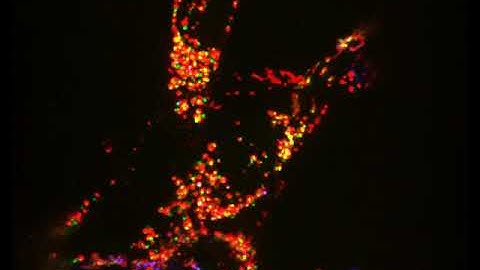 DNA gets away: scientists catch the rogue molecule that can trigger autoimmunity