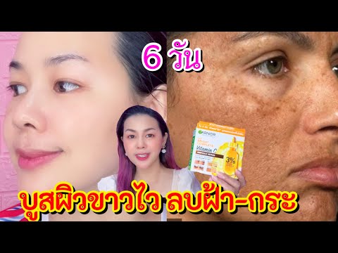 6 วัน🚩 บูสผิวขาวไว ลดฝ้า-กระ ฝ้าแดดจางไวมากๆ ด้วยการ์นิเย่ เซรั่ม |แม่นายมาแชร์