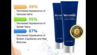 Ehowhealth - How To Remove Varicose Veins - Ehowhealth