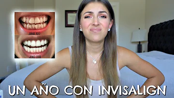 ¿Se debe utilizar pasta de dientes blanqueadora con Invisalign?