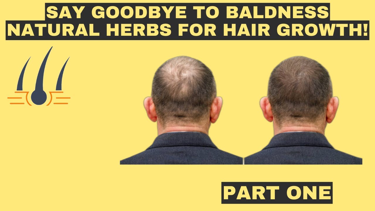Herbal remedies for baldness effective and safe solutions Treating