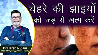 चेहरे की झाइयों को जड़ से ख़त्म करें || How to treat Melasma by homeopathy screenshot 2