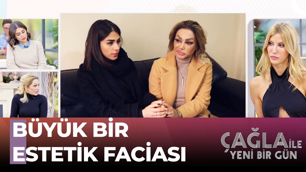 Estetik Mağduru Kadının Kabusa Dönen Hayatı - Çağla ile Yeni Bir Gün 940. Bölüm