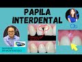 PAPILA INTERDENTAL 🦷con @PerioMX