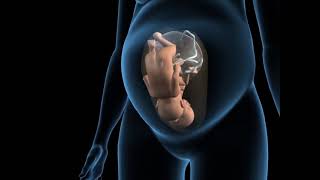 Types of twins pregnancy - Monochorionic monoamniotic twins - 3D Anatomical Visualization